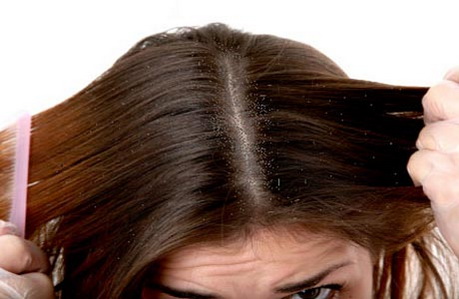 себорея волосистой части головы